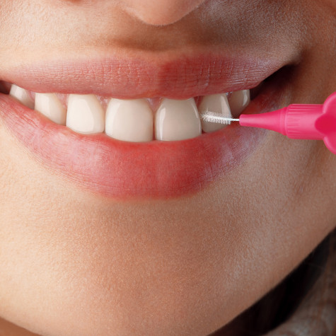 Ершики межзубные Revyline Smart, размер 0 (0,40 мм) розовые, 6 шт.